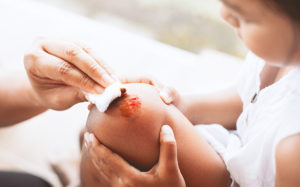 Do I Need A Lawyer For A Minor Injury? Here’S How To Decide.